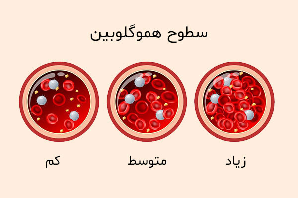 سطح هموگلوبین بالا چقدر است؟