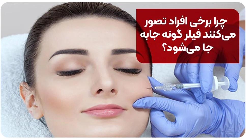 چرا برخی افراد تصور میکنند فیلر گونه جابهجا میشود؟