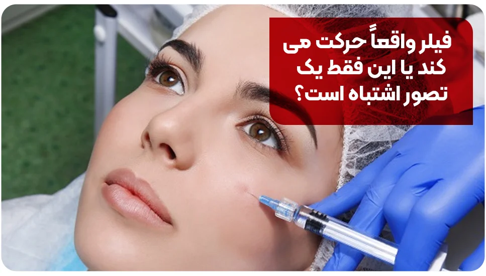 فیلر واقعاً حرکت میکند یا این فقط یک تصور اشتباه است؟